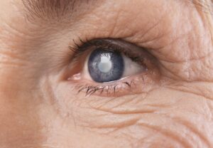 Read more about the article Not Just for the Nearsighted: Hidden Benefits of Laser Eye Surgery You Never Knew
